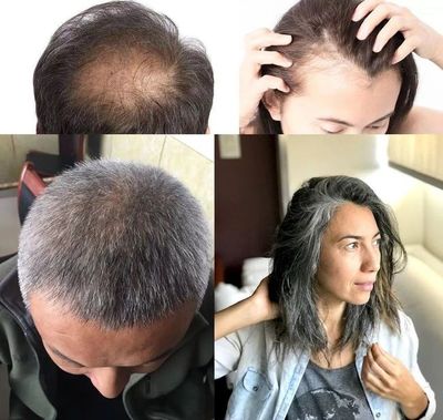 洗頭水中撒一把，頭發(fā)長(zhǎng)得又快又茂密，白發(fā)都沒(méi)了！